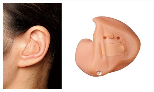 耳あな型オーダーメイド（ITE）